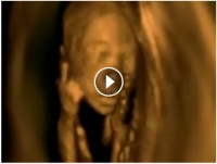 Visão de dentro do útero materno