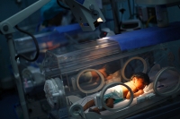 Entenda a relação entre cesariana marcada e o risco de prematuridade