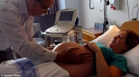 Com as mãos, médico 'vira' bebê dentro da barriga da mãe